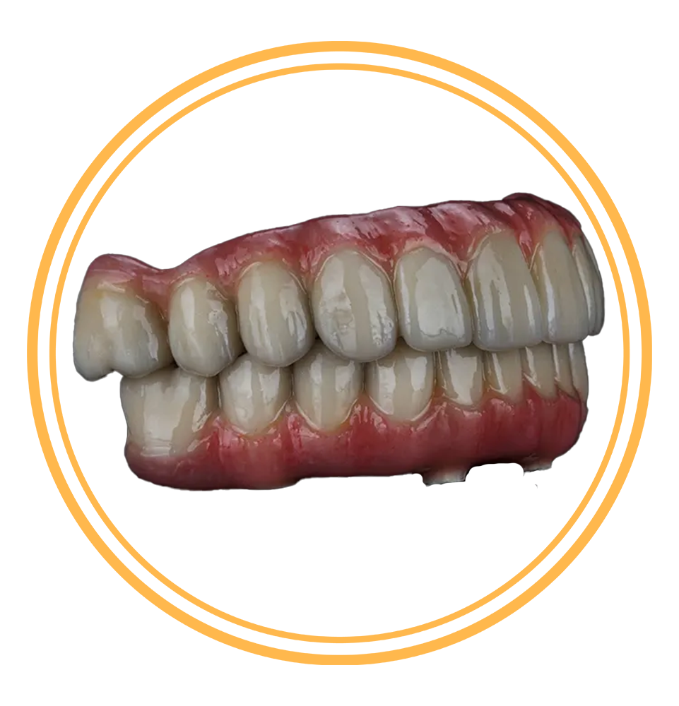 dental implants