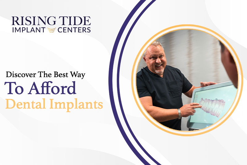 Discover The Best Way To Afford Dental Implants