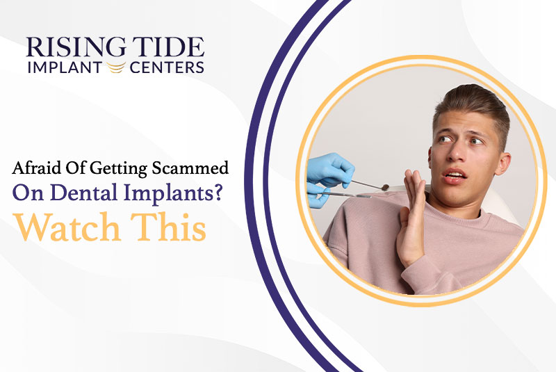 Afraid Of Getting Scammed On Dental Implants? Watch This