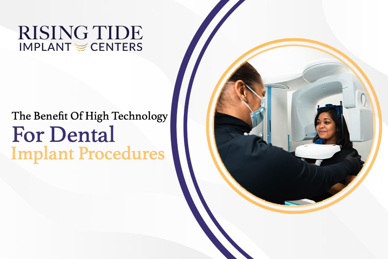 The Benefit Of High Technology For Dental Implant Procedures